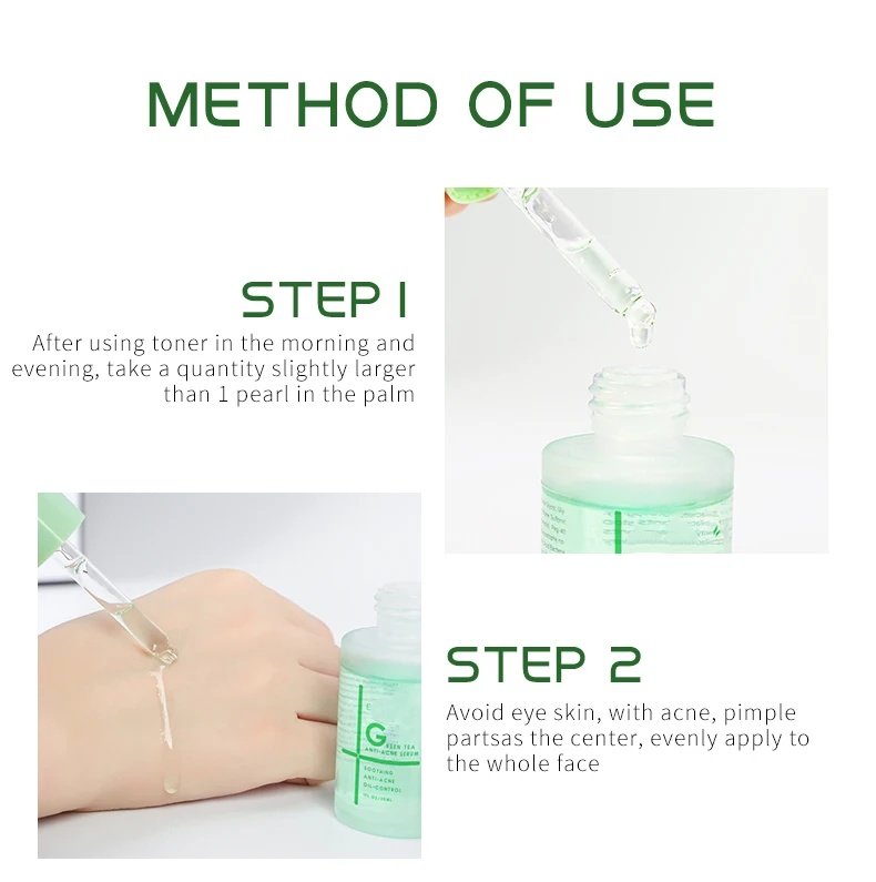 anti acne serum